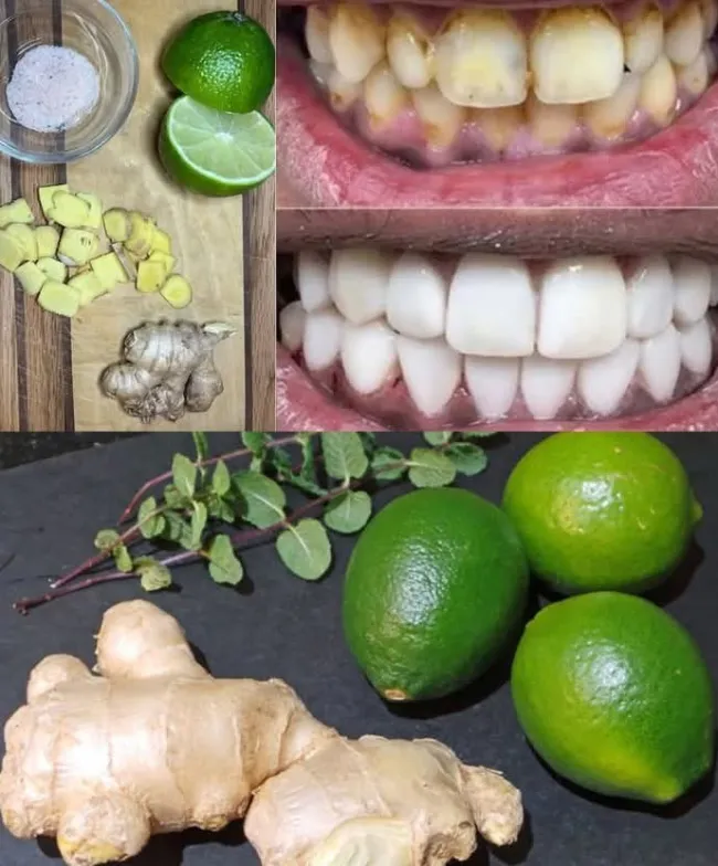 عوارض بلیچینگ دندان 4 عوارض بلیچینگ دندان در خانه